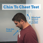 Stiff-neck-chin-to-chest-test