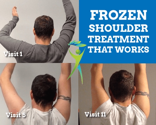 frozen shoulder cure one minute
